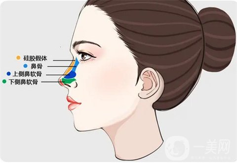 云南华美美莱余龙鼻部手术整形术后两个月恢复照分享