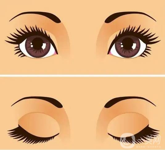 上海九院戴传昌做的全切双眼皮，*自然哦！