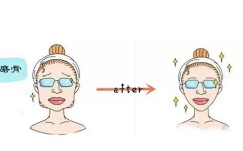 我在上海首尔丽格朴兴植做的下颌角切除，大量照片分享