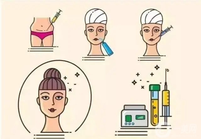 北京东方和谐冯斌做的自体脂肪填充全脸术后两个月*果分享