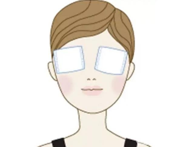 全切双眼皮真实感受分享，附恢复过程图