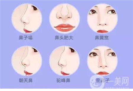 *整形+自体脂肪面部填充手术案例分享，精致面容不是梦