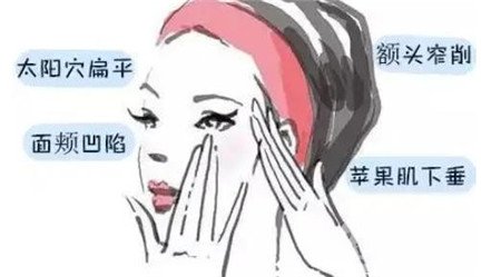 上海全脸自体脂肪填充打造精致脸型，果图大分享