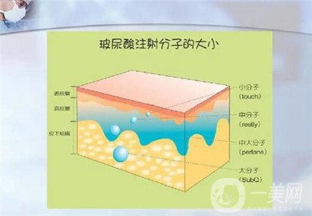 北京玻尿酸面部填充过程及果图分享