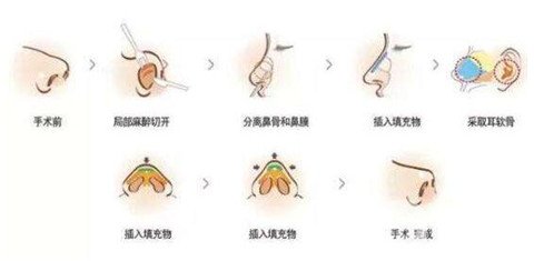 重庆当代徐在敦做的*术后*果分享，只花了一万多