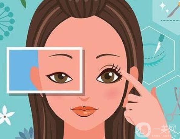 解放军海军总医院于燕全切双眼皮案例分享