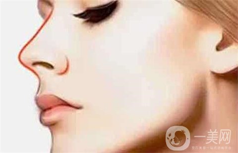 【硅胶隆鼻+双眼皮】手术过程及术后恢复照片分享