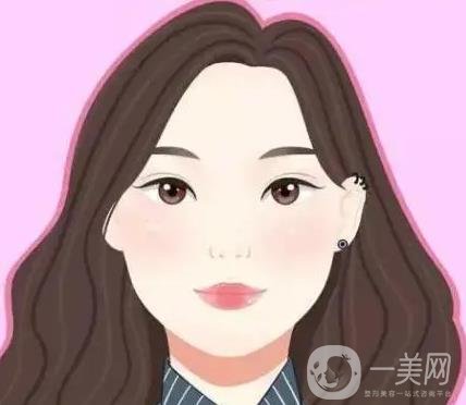 双眼皮割窄了怎么办？看看小姐姐的双眼皮修复案例吧！