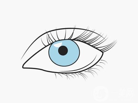 双眼皮割窄了怎么办？看看小姐姐的双眼皮修复案例吧！