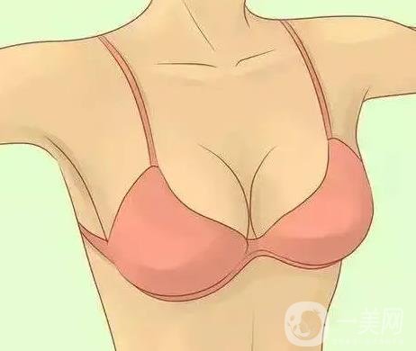 王自谦自体脂肪隆胸案例手术恢复过程分享