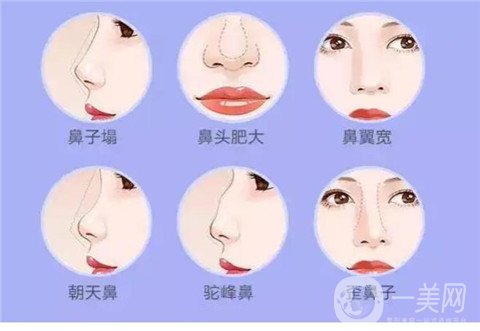 桂行军*整形手术前后图,变化惊人