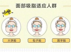 面部吸脂手术需要戴头套吗?要戴多久