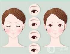 开眼角后可以抽烟吗?有什么坏处?