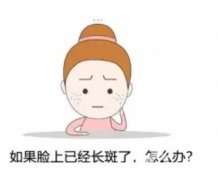 激光去斑有什么优点，有哪些需要注意