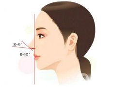 鼻整形手术排斥反应有哪些症状?