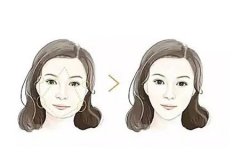 去除颊脂垫是怎么做的