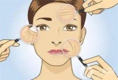 超声刀抗衰老的重点跟温度和深度有关吗?