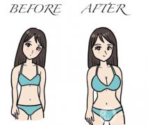 影响巨乳缩小手术效果的因素有哪些