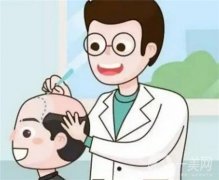 植发的佳时间是什么时候