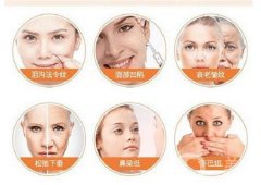 用透明质酸填充泪沟安全吗?失败怎么办