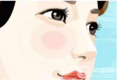 鼻翼内切的安全性和注意事项