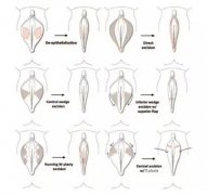 私密整形手术安全吗，项目一般有哪些