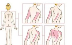 通过吸脂术可以减掉多少体重