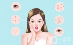 热玛吉怎么样?可以去眼袋吗?