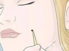 激光点痣后十天恢复图片及真实案例分享一览！