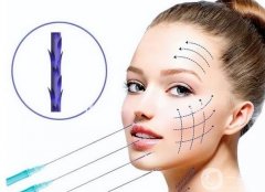 面部线雕一般价格多少钱？可以维持多久？附一到7天图片展示