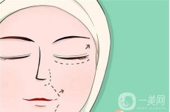 双眼皮怎么埋线？过程图分享！优势、价格一览