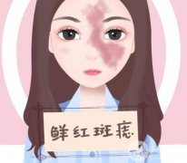 激光去痣的危害有哪些