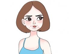 激光祛痘印有效吗，为什么会留下疤痕