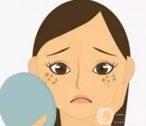 激光祛斑原理及优点和缺点是什么