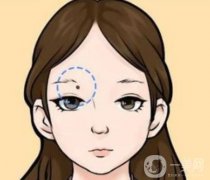 激光去痣后有哪些食物应该忌口？