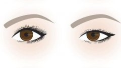 眼综合整形多久恢复？眼综合真实恢复期图片1到7天详细