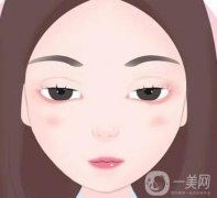 什么是上眼睑提升术?应注意哪些事项