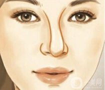 影响鼻骨矫正费用的因素有哪些