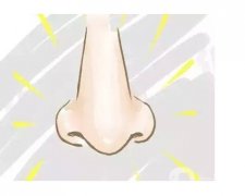 鹰钩鼻矫正安全吗，注意事项有哪些