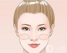 注射玻尿酸填充苹果肌有什么优势?