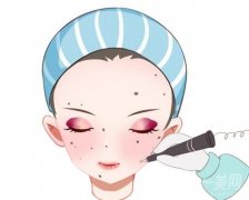 激光点痣1到7天图参考！激光点痣多久能恢复正常？