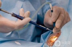 眼睛手术调节近视多少钱？飞秒近视眼手术佳年龄和度数？