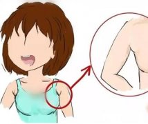 副乳切除术有哪些风险和并发症?