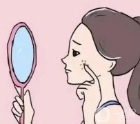 激光痣点后出现凹坑怎么办