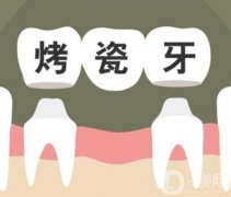 烤瓷牙是如何安装的，有异味怎么办