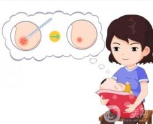 乳头缩小手术有何特点，会影响母乳喂养吗