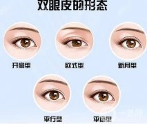 切双眼皮和埋线双眼皮哪个好？附正规靠谱医院推荐