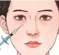 有哪些填充卧蚕的方法？