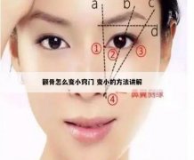 颧骨会自己变小吗？脸部凹陷怎么恢复饱满？