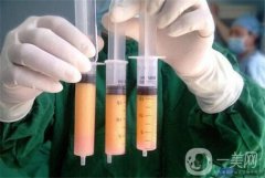 腹部抽脂的费用大概是多少？对身体有害吗？会反弹吗